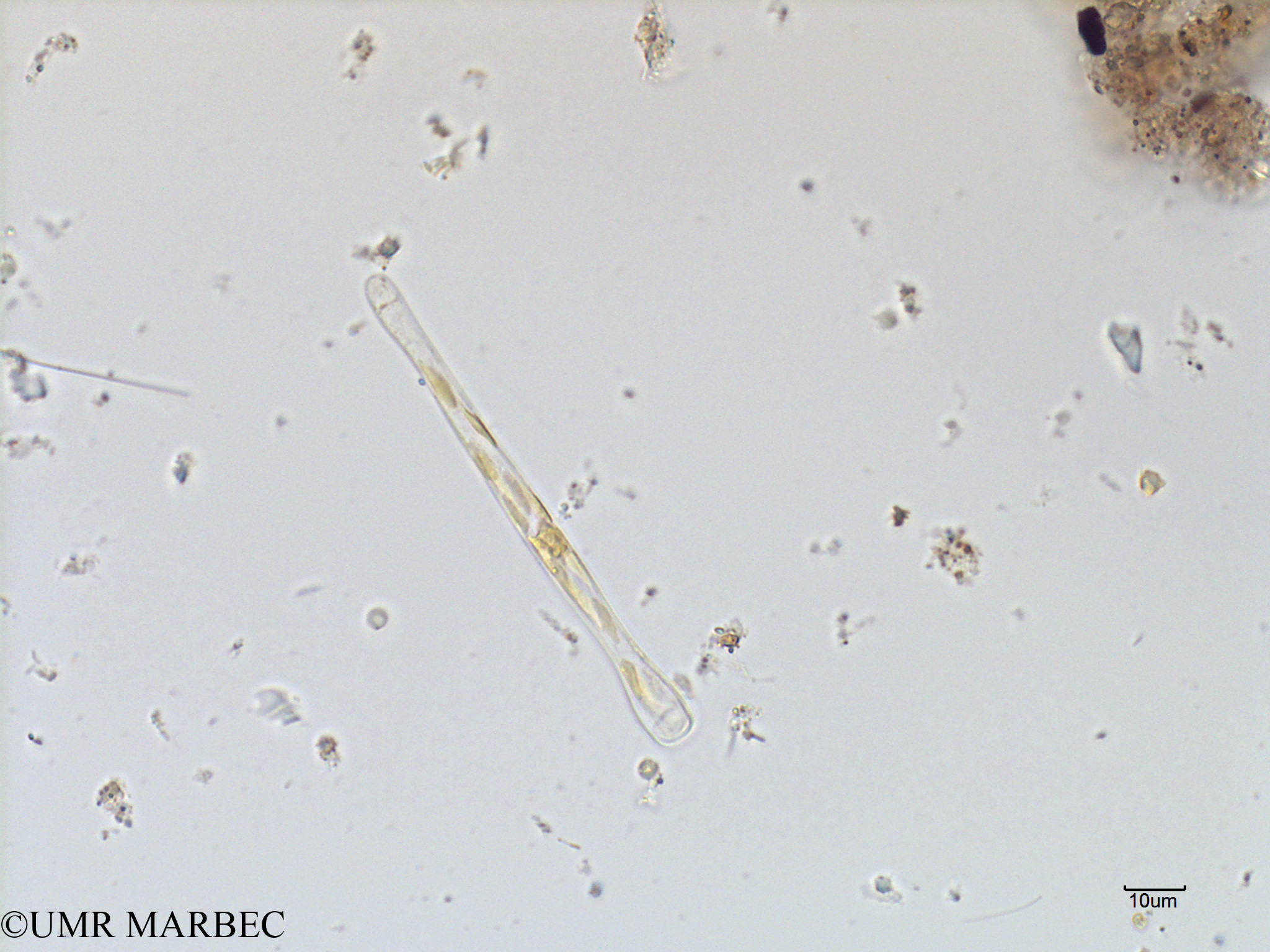 phyto/Scattered_Islands/mayotte_lagoon/SIREME May 2016/Asterionella sp3 (MAY4_tipo asterionella-5).tif(copy).jpg